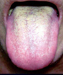 赤ちゃん 舌 黒い 点