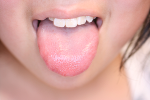 舌診について はぎの内科クリニック