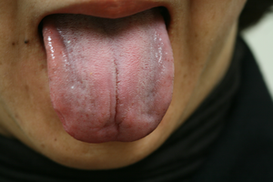 舌診各論１ はぎの内科クリニック